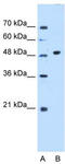 Glycosyltransferase Like Domain Containing 1 antibody, TA346828, Origene, Western Blot image 