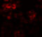 Dual Specificity Tyrosine Phosphorylation Regulated Kinase 2 antibody, A03498, Boster Biological Technology, Immunofluorescence image 