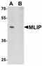 Muscular LMNA-interacting protein antibody, orb75731, Biorbyt, Western Blot image 
