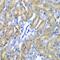 Crystallin Alpha A antibody, GTX65843, GeneTex, Immunohistochemistry paraffin image 