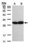 TPI antibody, PA5-21583, Invitrogen Antibodies, Western Blot image 