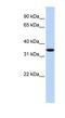 RING finger protein 171 antibody, NBP1-59758, Novus Biologicals, Western Blot image 