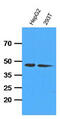 Adenosine Kinase antibody, MBS200208, MyBioSource, Western Blot image 