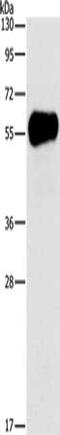 Amylase Alpha 2A (Pancreatic) antibody, CSB-PA908401, Cusabio, Western Blot image 