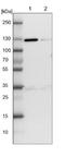 Ubiquitin Like Modifier Activating Enzyme 6 antibody, NBP1-87911, Novus Biologicals, Western Blot image 