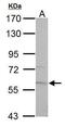 Pyruvate Kinase L/R antibody, GTX107873, GeneTex, Western Blot image 