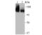 Lysine Acetyltransferase 2B antibody, NBP2-75608, Novus Biologicals, Western Blot image 
