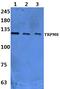 Tribbles Pseudokinase 3 antibody, PA5-75683, Invitrogen Antibodies, Western Blot image 