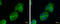 Insulin-like growth factor-binding protein 2 antibody, GTX128977, GeneTex, Immunofluorescence image 