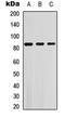 Serum/Glucocorticoid Regulated Kinase 1 antibody, orb304579, Biorbyt, Western Blot image 