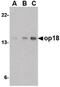 Stathmin 1 antibody, LS-B16376, Lifespan Biosciences, Western Blot image 