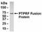 Protein Tyrosine Phosphatase Receptor Type F antibody, NB100-75290, Novus Biologicals, Western Blot image 