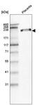 Laminin Subunit Beta 1 antibody, AMAb91092, Atlas Antibodies, Western Blot image 