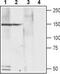 Calcium Voltage-Gated Channel Auxiliary Subunit Alpha2delta 4 antibody, TA328762, Origene, Western Blot image 