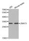 Zinc Finger Matrin-Type 3 antibody, abx003748, Abbexa, Western Blot image 