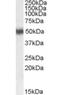 Retinoic Acid Receptor Alpha antibody, orb18965, Biorbyt, Western Blot image 