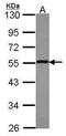 Proteasome 26S Subunit, Non-ATPase 4 antibody, PA5-30136, Invitrogen Antibodies, Western Blot image 