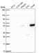 Peroxisome Proliferator Activated Receptor Alpha antibody, NBP2-57777, Novus Biologicals, Western Blot image 