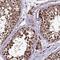 Zinc Finger Protein 766 antibody, NBP1-92643, Novus Biologicals, Immunohistochemistry frozen image 