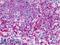 Hematopoietic Cell-Specific Lyn Substrate 1 antibody, LS-B4340, Lifespan Biosciences, Immunohistochemistry frozen image 