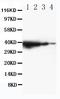 Toll Like Receptor Adaptor Molecule 1 antibody, PA2001, Boster Biological Technology, Western Blot image 