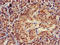 Tripartite motif-containing protein 5 antibody, LS-C679898, Lifespan Biosciences, Immunohistochemistry paraffin image 