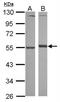 Alpha-1-antitrypsin antibody, NBP2-15349, Novus Biologicals, Western Blot image 
