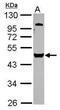 Vacuolar Protein Sorting 4 Homolog B antibody, PA5-30316, Invitrogen Antibodies, Western Blot image 