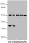 Serine/threonine-protein phosphatase 2A regulatory subunit B subunit gamma antibody, LS-C676305, Lifespan Biosciences, Western Blot image 