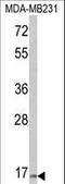 Thyroid Stimulating Hormone Subunit Beta antibody, LS-C160252, Lifespan Biosciences, Western Blot image 