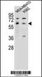 5-Hydroxytryptamine Receptor 3A antibody, 56-271, ProSci, Western Blot image 