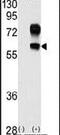 Kringle Containing Transmembrane Protein 1 antibody, PA5-11624, Invitrogen Antibodies, Western Blot image 