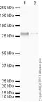 Heat Shock Protein Family A (Hsp70) Member 5 antibody, ab21685, Abcam, Western Blot image 