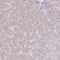 Eukaryotic Translation Initiation Factor 2B Subunit Beta antibody, HPA048028, Atlas Antibodies, Immunohistochemistry paraffin image 