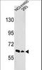 EPH Receptor A3 antibody, LS-B8780, Lifespan Biosciences, Western Blot image 