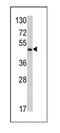 Ornithine Carbamoyltransferase antibody, ab91418, Abcam, Western Blot image 