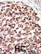 Protein Kinase D3 antibody, abx033123, Abbexa, Immunohistochemistry paraffin image 
