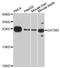 Glutathione S-Transferase Mu 3 antibody, A7679, ABclonal Technology, Western Blot image 