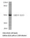 Glycogen Synthase Kinase 3 Alpha antibody, LS-C176051, Lifespan Biosciences, Western Blot image 