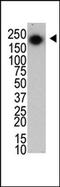 Leucine Rich Repeat Kinase 2 antibody, AM11057PU-N, Origene, Western Blot image 