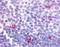 Cannabinoid Receptor 2 antibody, NLS33, Novus Biologicals, Immunohistochemistry frozen image 