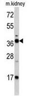 Fructose-Bisphosphatase 1 antibody, GTX81482, GeneTex, Western Blot image 