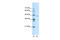 Amiloride-sensitive cation channel 4 antibody, 28-308, ProSci, Western Blot image 