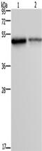 Forkhead Box A1 antibody, TA350666, Origene, Western Blot image 