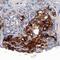 Insulin Receptor Substrate 1 antibody, AF3978, R&D Systems, Immunohistochemistry paraffin image 