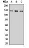 Signal-Induced Proliferation-Associated 1 antibody, orb411959, Biorbyt, Western Blot image 