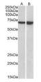 Lymphocyte Cytosolic Protein 1 antibody, orb195354, Biorbyt, Western Blot image 