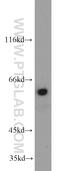 Thyroid Hormone Receptor Interactor 4 antibody, 12324-1-AP, Proteintech Group, Western Blot image 