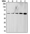 Transforming Growth Factor Beta Receptor 1 antibody, orb214664, Biorbyt, Western Blot image 