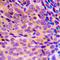 Nuclear Factor Kappa B Subunit 1 antibody, LS-C352584, Lifespan Biosciences, Immunohistochemistry paraffin image 
